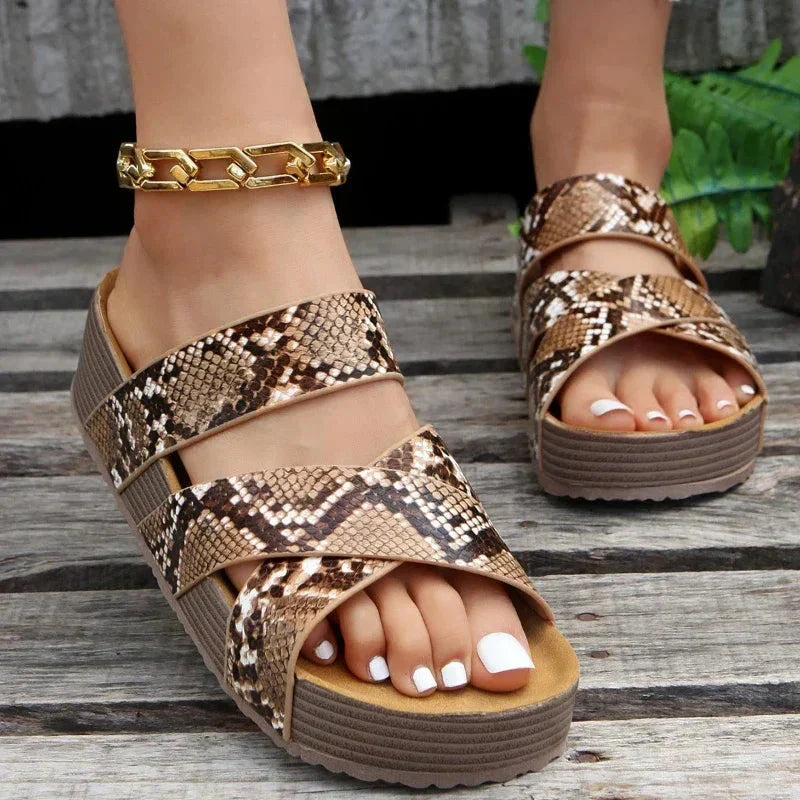 Women’s Orthopedic Wedge Sandals – Comfort Meets Chic for All-Day Wear